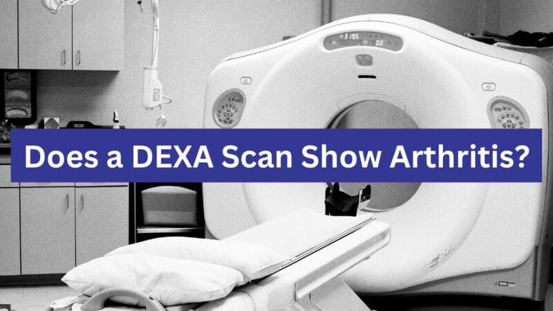 does a dexa scan show arthritis thumbnail